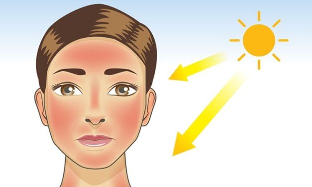 Paparan UV Yang Kontak Langsung Ke Kulit Berdampak Buruk