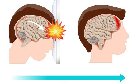 Cedera Concussion Atau Geger Otak Yang Di Alamin Seseorang